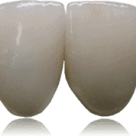 Empress Anterior