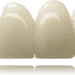 Provisionals