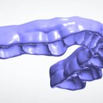 bite_splint_design