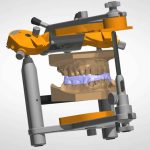 bite_splint_design_w_articulator