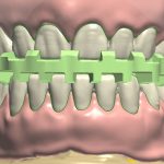 dentureteeth_positioning_guide