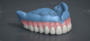 Reline Tryin Denture