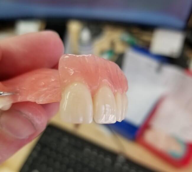 Flipper Partial CAE Dental