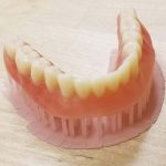 3D Printed Denture
