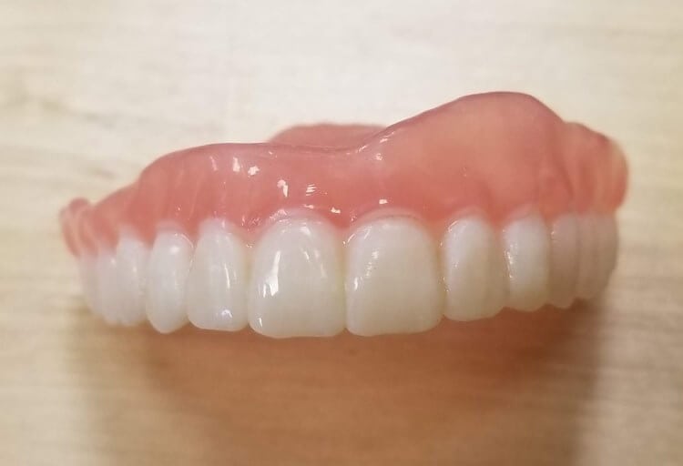 Partial Flipper Teeth