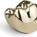 Gold_Crown_2
