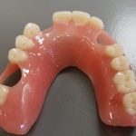 acrylic_partial