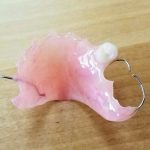 flipper_1_tooth_3_clasps