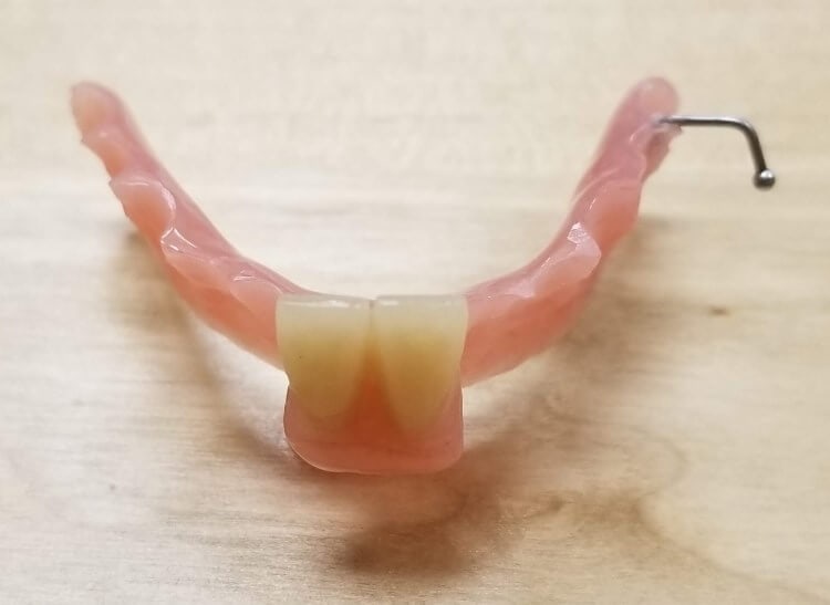 Flipper Partial - CAE Dental