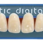 Artic_digital_tooth_mould