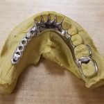 metal_partial_frame