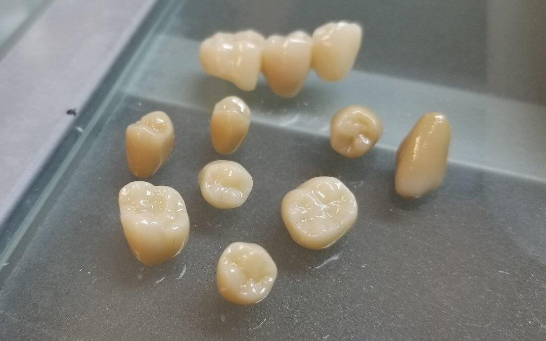 The All Zirconia Crown