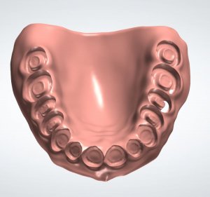 Denture Design Manual Cut Guide