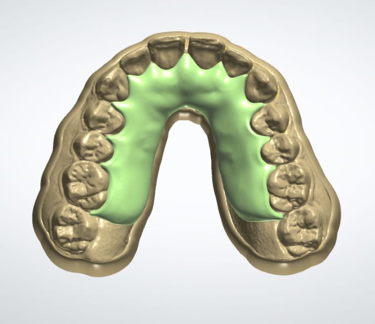 Retainer Base Plate – CAD Design – CAE Dental